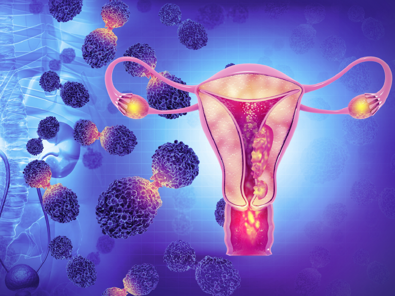 Gynecological Cancer Screening