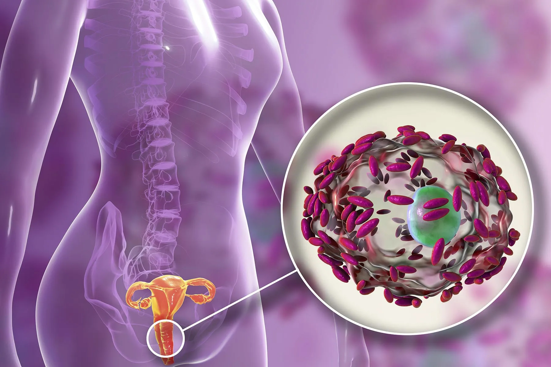 Vaginal Infections Treatment